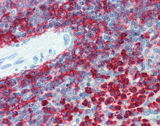 IHC - ITGB2 / CD18 Antibody (aa534-546, clone MEM-48) ALS12925